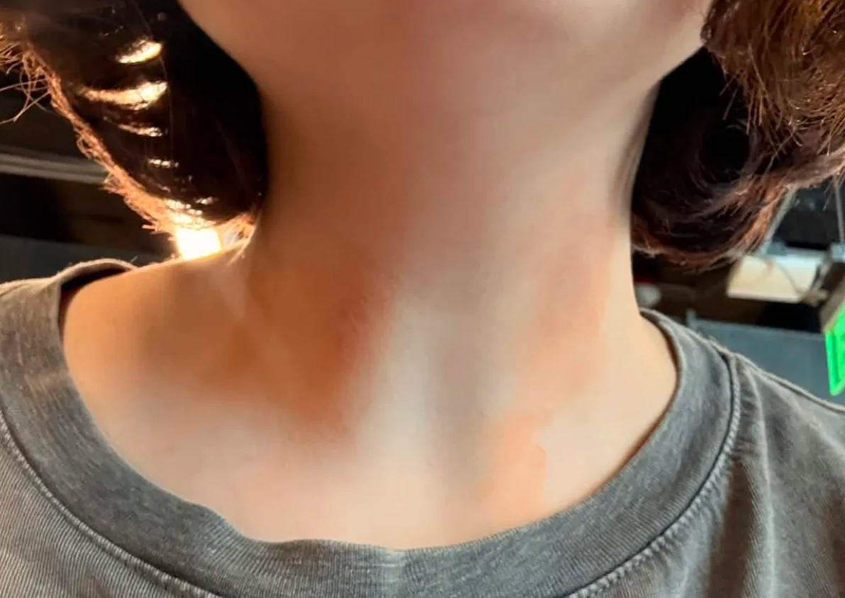 Поздняя стадия