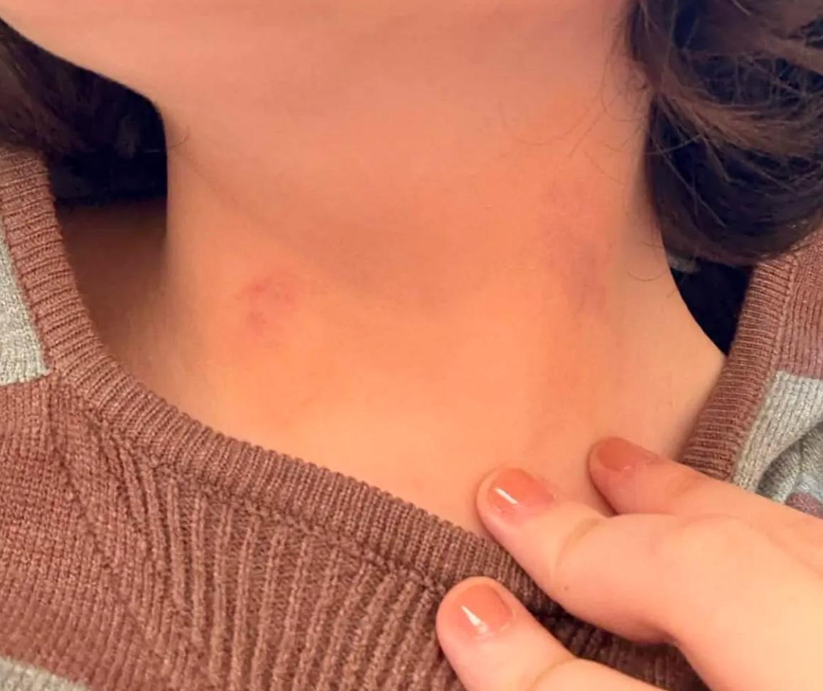 След под подбородком