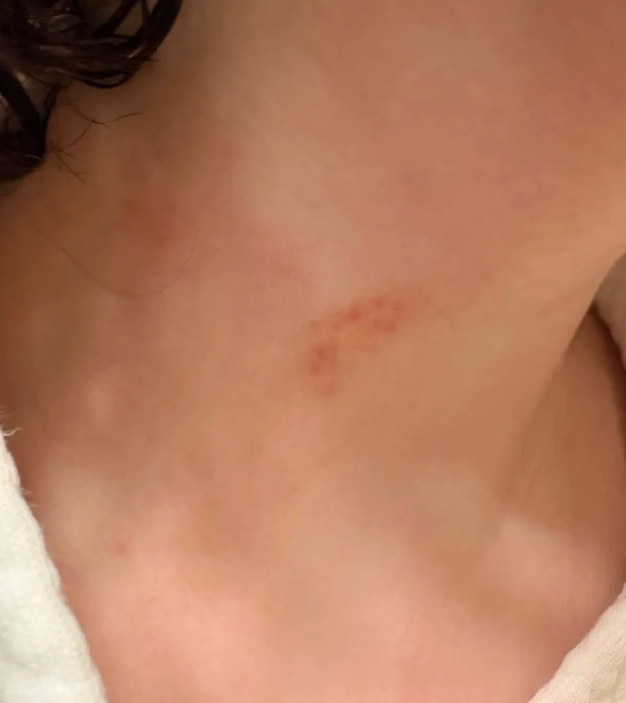 Следы на ключице